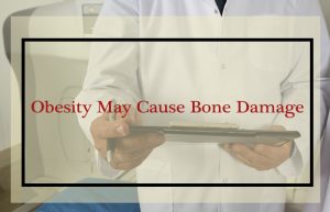 Hologic bone density machine
