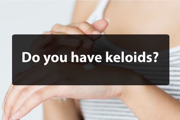 Do You Have Keloids ?
