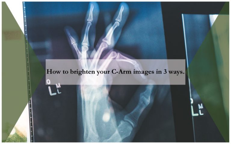 How to brighten your C-Arm images in 3 ways.