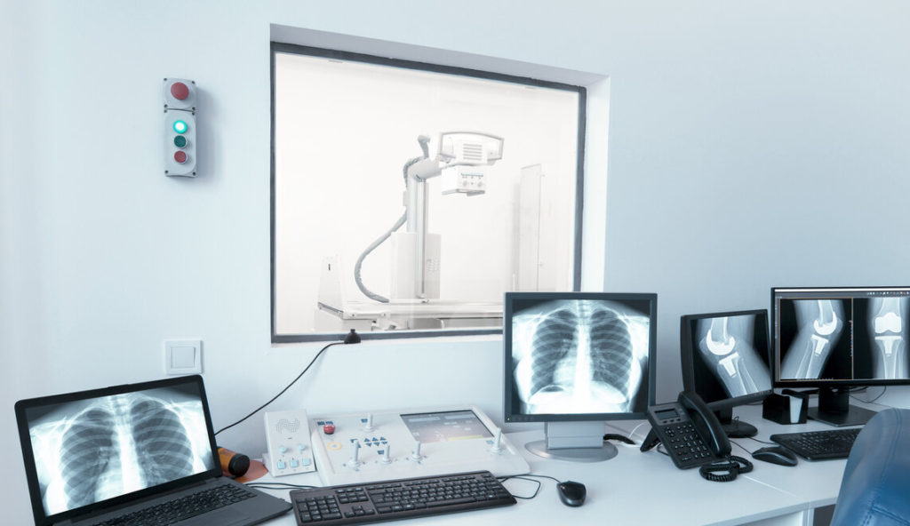 A Purchasing Insight on Portable X-ray Machines.